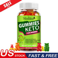 Keto ACV Gummies - Advanced ACV Keto Weight Loss Burn Fat Dietary Supplement