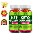 Minch Keto ACV Gummies 2000MG Detoxing Gummies Dietary Supplement Pack of 2