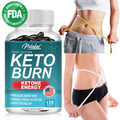 Keto BHB Capsules - Weight Loss, Appetite Suppressant, Liver Detox - Fat Burner