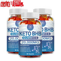1-3PCS Keto BHB Gummies For Weight Loss Fat Burner Appetite Suppressant 20000MG