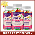 Mulittea Keto ACV Gummies - Weight Loss,Fat Burner,Appetite Suppressant,Detox