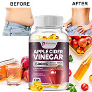 Apple Cider Vinegar 1300mg - Weight Loss, Appetite Suppression, Body Detox