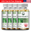 Saw Palmetto Extract Prostate Capsules Male Health Prevent Hari Loss (1-4Packs)