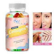 Biotin Collagen Vitamin Gummies for Hair Skin Nails, Premium Collagen Supplement