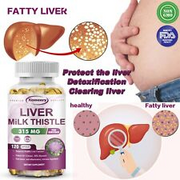 Liver Milk Thistle 315mg -Liver Cleanse, Detox & Repair Formula - with Silymarin
