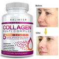 Hydrolyzed Collagen Supplement - for Skin, Hair, Nail Health, Type I, II, III, V
