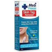 Medi Freeze Skin Tag Remover OzHealthExperts