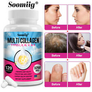 Collagen Types I, II, III, V, X 3250 Mg Supplement Skin Health Capsules